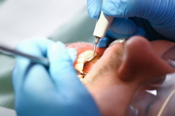 Best Emergency Treatment for Toothache in Franklin Lakes, NJ