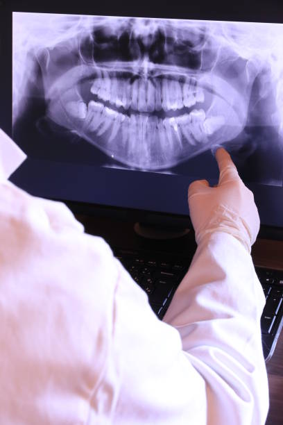 Best Emergency Tooth Extraction in Franklin Lakes, NJ